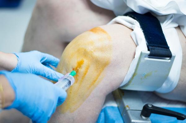 joint treatment in nashik